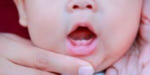 Cara Mengatasi Demam Tumbuh Gigi pada Bayi 